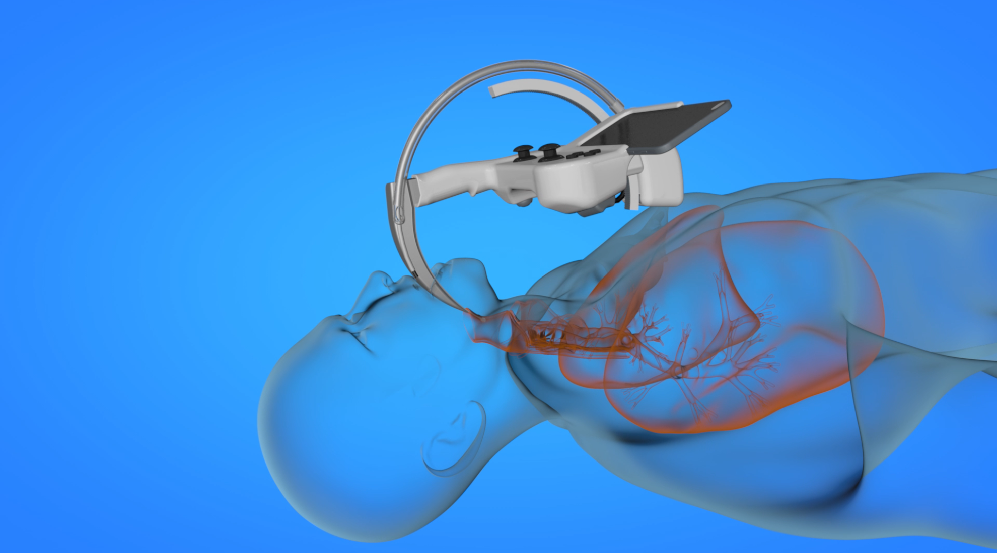 intuBot visualization