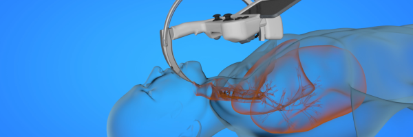 intuBot visualization