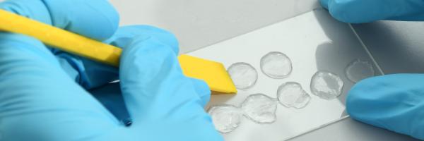 The new 3D skin model will allow scientists to simulate skin diseases and thus better understand them. Source: Empa